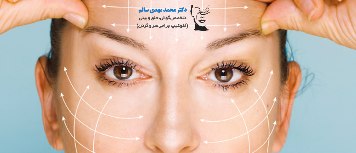 درباره لیفت آندوسکوپی صورت