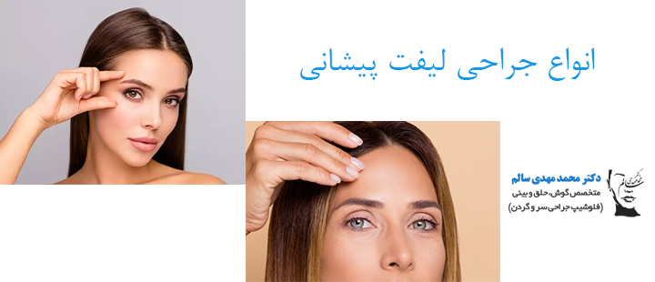 جراحی لیفت پیشانی چه انواعی دارد؟