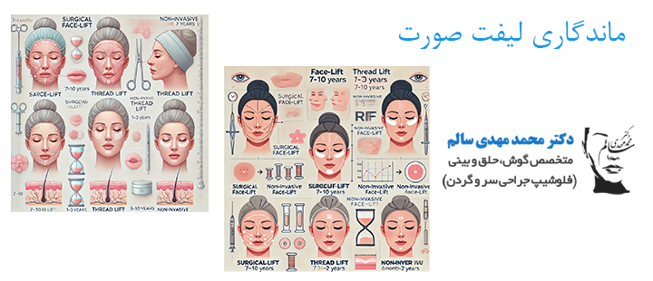 درباره ماندگاری لیفت صورت ز