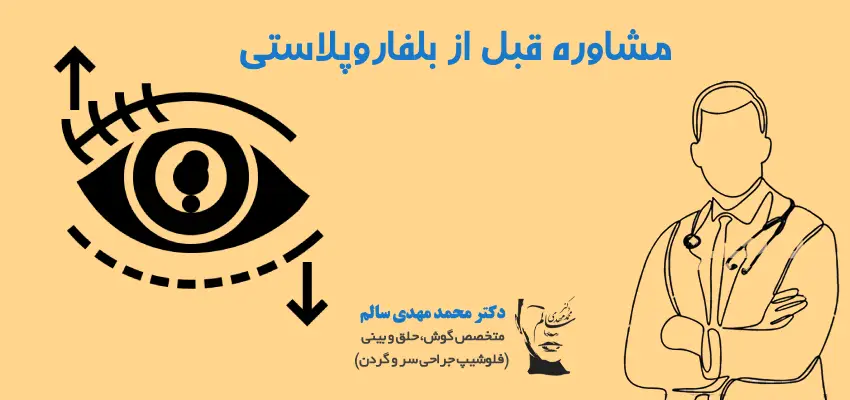 مشاوره قبل از بلفاروپلاستی