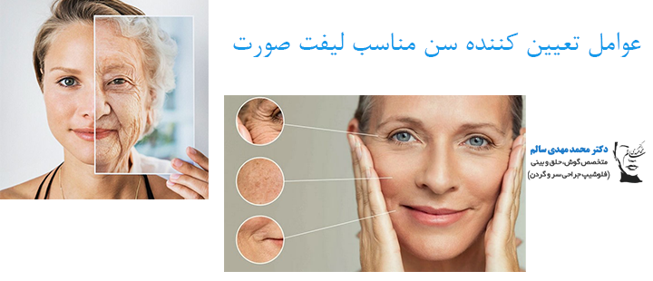 عوامل تعیین کننده سن مناسب لیفت صورت
