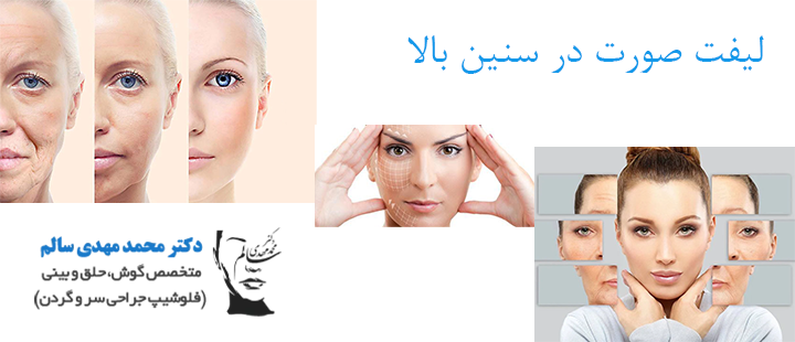 لیفت صورت در سنین بالا