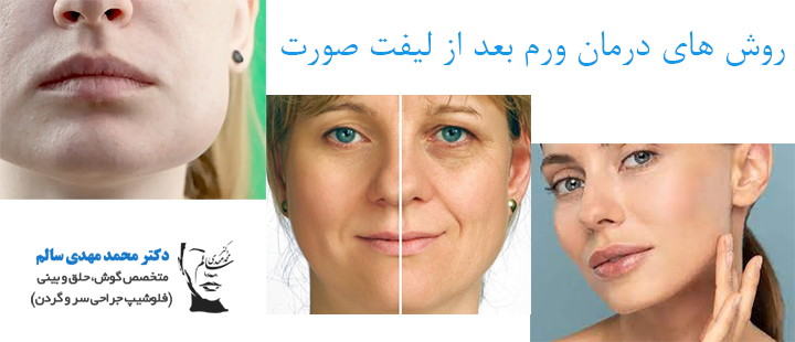 روش های درمان ورم بعد از لیفت صورت