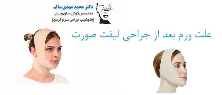 علت ورم بعد از جراحی لیفت صورت