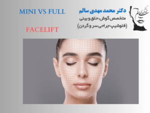 لیفت-صورت-یا-مینی-لیفت (1)