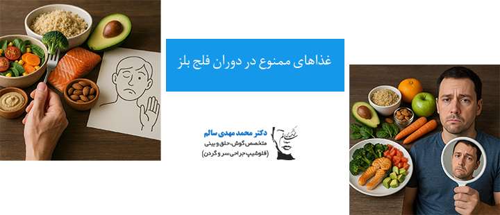 غذاهای ممنوع در دوران فلج بلز