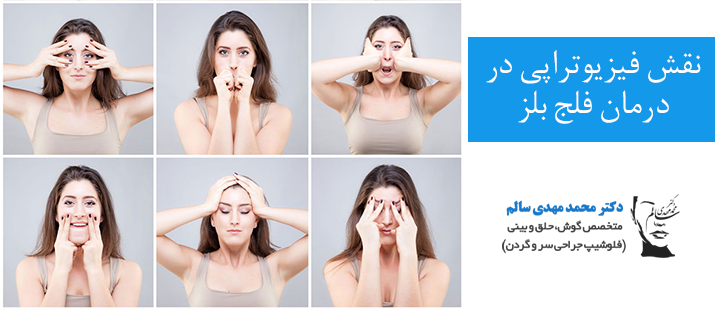 نقش فیزیوتراپی در درمان فلج بلز