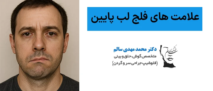 علامت های فلج لب پایین