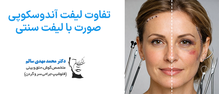 تفاوت لیفت آندوسکوپی صورت با لیفت سنتی