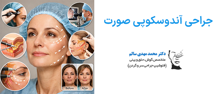 جراحی آندوسکوپی صورت چیست؟