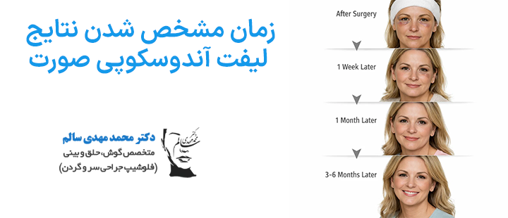 زمان مشخص شدن نتایج لیفت آندوسکوپی صورت