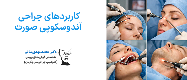 کاربردهای جراحی آندوسکوپی صورت