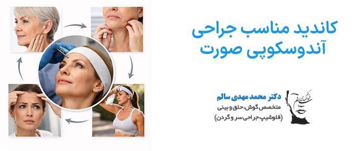 کاندید مناسب لیفت آندوسکوپی صورت