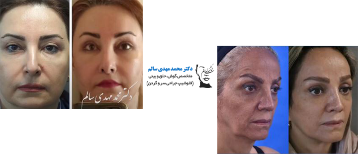 نمونه کار دکتر سالم