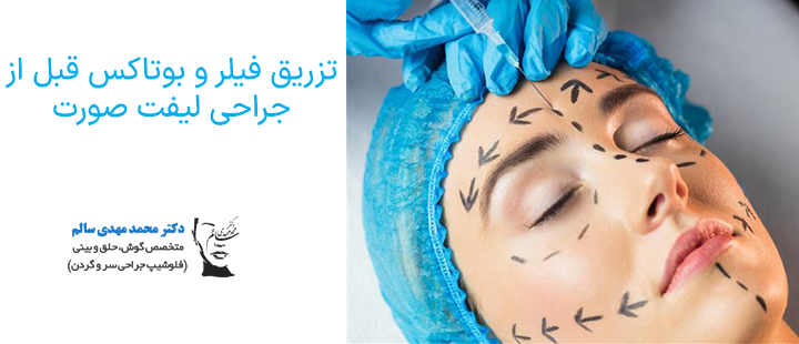 تزریق فیلر و بوتاکس قبل از جراحی لیفت صورت