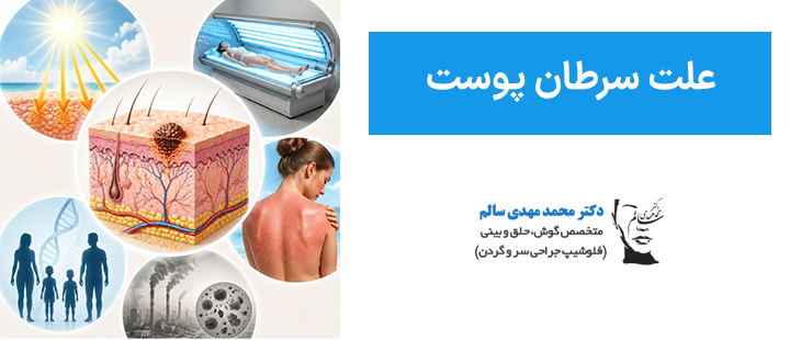 علت سرطان پوست